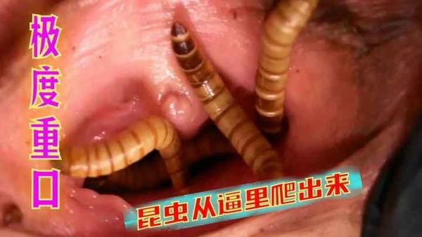 昆虫从逼里爬出来