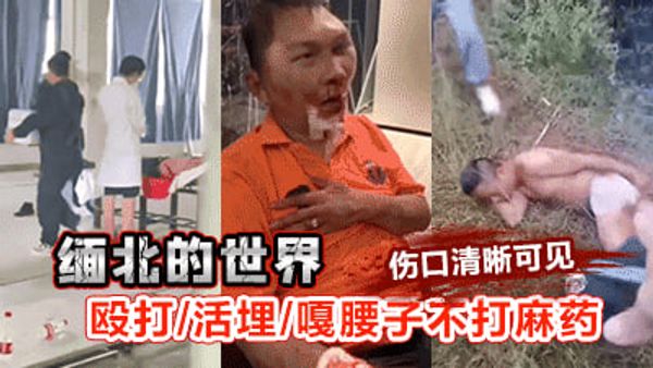 缅北的世界，殴打，活埋，嘎腰子不打麻药，伤口清晰可见